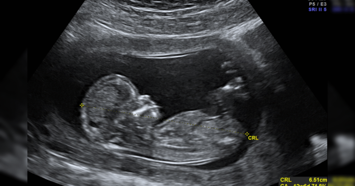 Priests for Life: Call on the FDA to End Death by Chemical Abortion